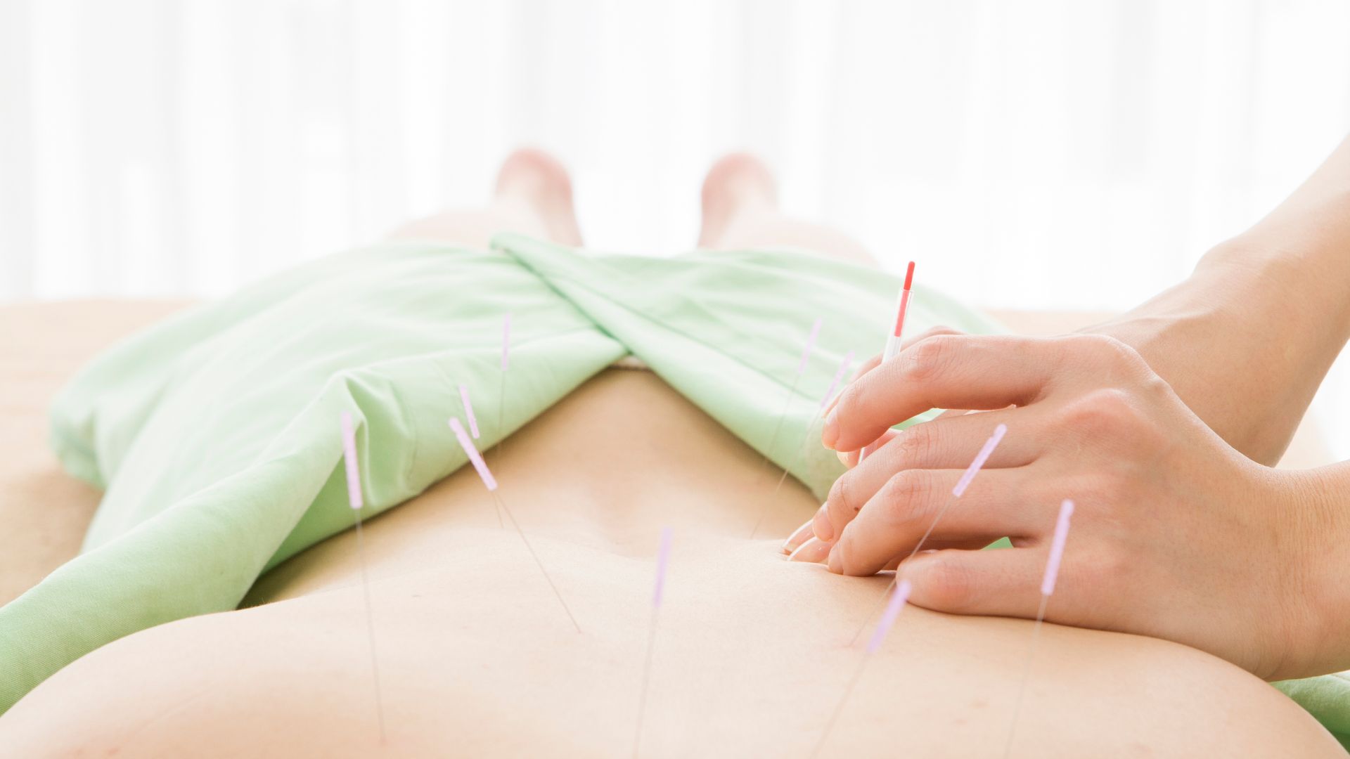 Acupuncture for Healing